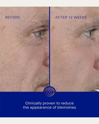Augustinus Bader The Serum with TFC8, 1.7 oz. | Thumbnail 5 Augustinus Bader The Serum with TFC8, 1.7 oz. | Thumbnail 5