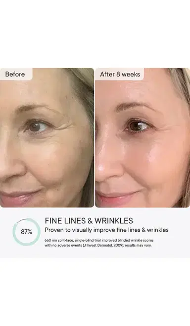 Qure Skincare Q-Rejuvalight Pro Facewear LED Mask | Thumbnail 2