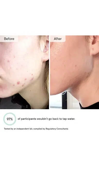 Qure Skincare Faucet Filter | Thumbnail 7