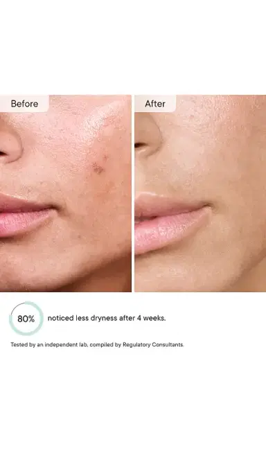 Qure Skincare Faucet Filter | Thumbnail 8