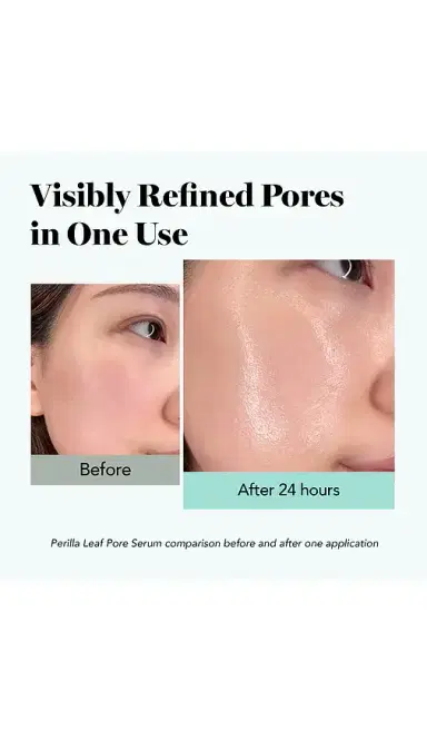 Saturday Skin Perilla Leaf Pore Serum | Thumbnail 8