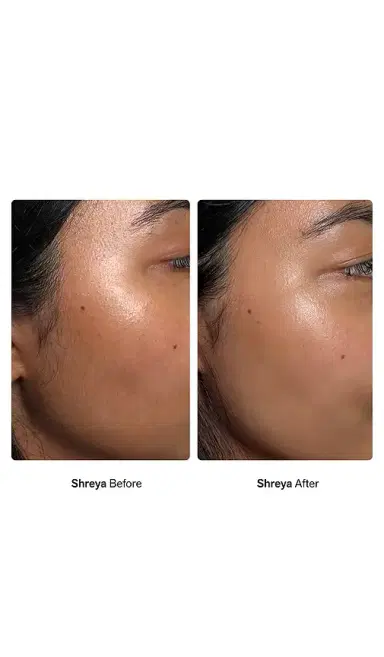 Nimbi Facial Dermaplaners 12 Pack | Thumbnail 7