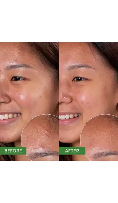 Sand & Sky Oil Control Clearing Cleanser | Thumbnail 3