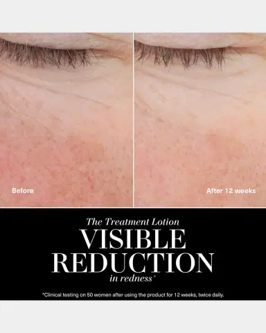 La Mer The Treatment Lotion | Thumbnail 5 La Mer The Treatment Lotion | Thumbnail 5