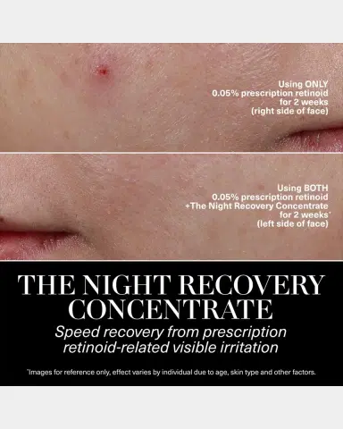 La Mer The Night Recovery Concentrate | Thumbnail 4 La Mer The Night Recovery Concentrate | Thumbnail 4