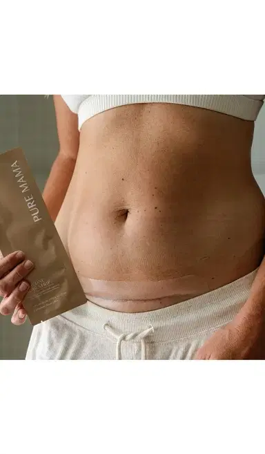 Pure Mama Silicone Scar Strip | Thumbnail 2