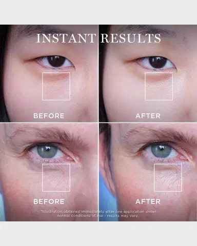 Lancôme Advanced Génifique YeuxYouth Activating Smoothing Eye Cream, 0.5 oz. | Thumbnail 5 Lancôme Advanced Génifique YeuxYouth Activating Smoothing Eye Cream, 0.5 oz. | Thumbnail 5