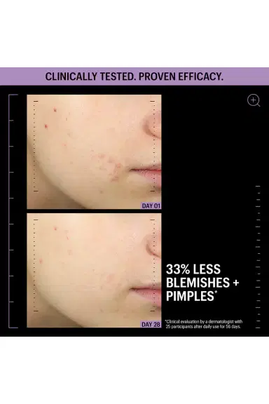 Allies of Skin Azelaic & Kojic Advanced Clarifying Serum 1oz | Thumbnail 2