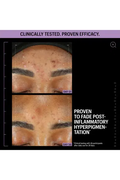 Allies of Skin Azelaic & Kojic Advanced Clarifying Serum 1oz | Thumbnail 3