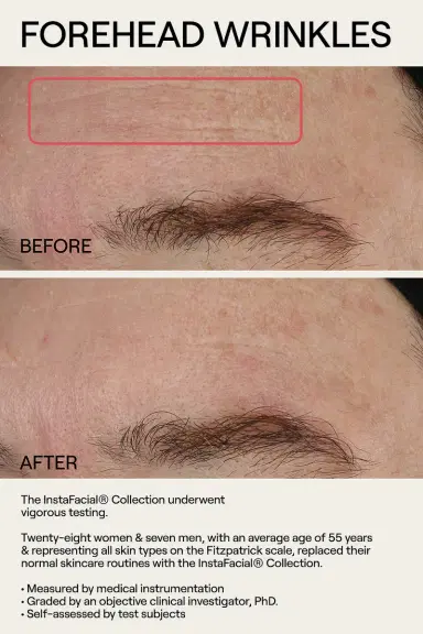 Dr. Diamond's Metacine InstaFacial Emulsion Retinopro Growth Factor Night Cream 50g | Thumbnail 5
