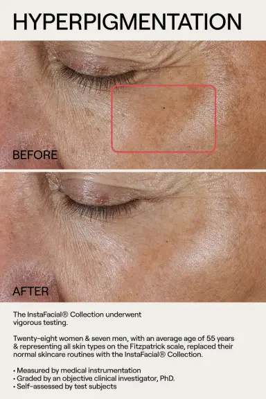 Dr. Diamond's Metacine InstaFacial Emulsion Retinopro Growth Factor Night Cream 50g | Thumbnail 7