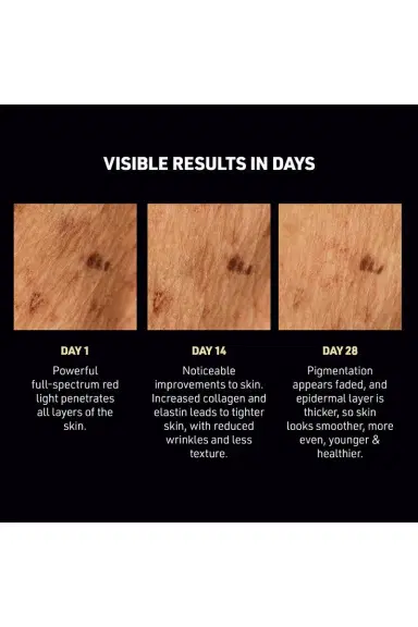 Foreo FAQ 502 DPL Photorejuvenation Skin Renewal Device | Thumbnail 7