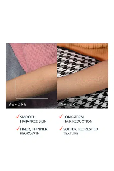Foreo Peach 2 Pro Max IPL Hair Removal Device | Thumbnail 6