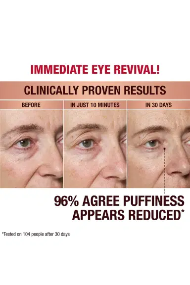 Charlotte Tilbury Charlotte's Hollywood Skin Secrets Immediate Eye Revival Patches | Thumbnail 3