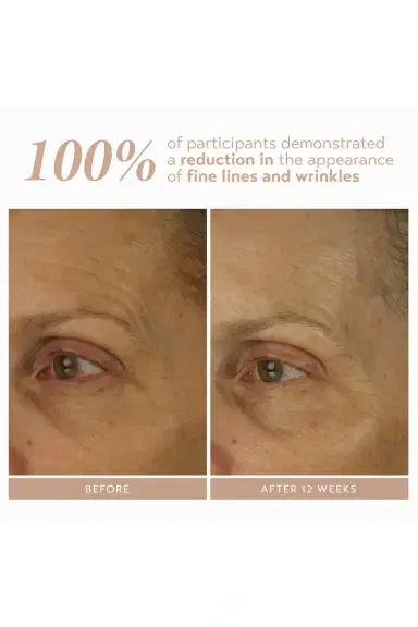 Shani Darden Skin Care Retinol Reform With 1% Encapsulated Retinol 10ml | Thumbnail 3