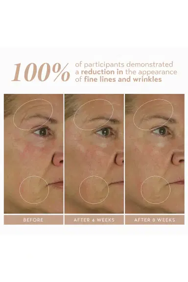 Shani Darden Skin Care Retinol Reform With 1% Encapsulated Retinol 10ml | Thumbnail 4