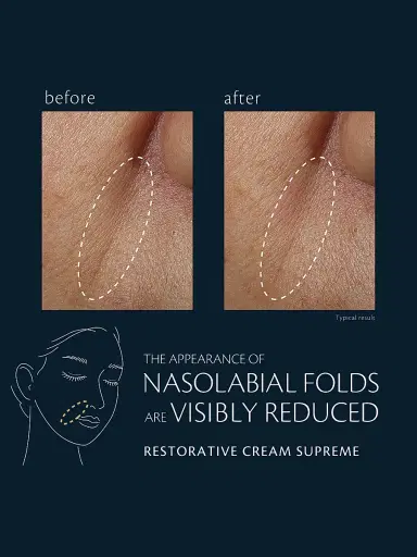 CLÉ DE PEAU BEAUTÉ Restorative Cream Supreme Refill | Thumbnail 3 CLÉ DE PEAU BEAUTÉ Restorative Cream Supreme Refill | Thumbnail 3