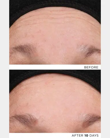 Noble Panacea The Exceptional RetiNAD+ Renewal Booster | Thumbnail 4 Noble Panacea The Exceptional RetiNAD+ Renewal Booster | Thumbnail 4