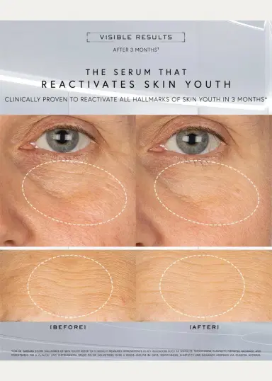 Dr. Barbara Sturm Super Anti-Aging Serum, 1 oz. | Thumbnail 2