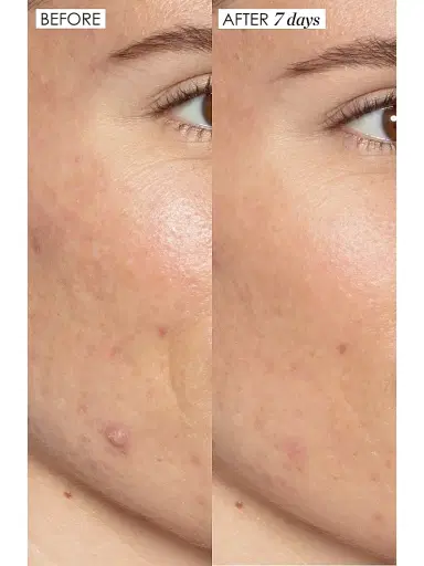 Sunday Riley Good Genes All-In-One Lactic Acid Treatment 1 oz | Thumbnail 2 Sunday Riley Good Genes All-In-One Lactic Acid Treatment 1 oz | Thumbnail 2