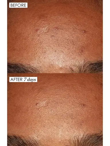 Sunday Riley Good Genes All-In-One Lactic Acid Treatment 1 oz | Thumbnail 3 Sunday Riley Good Genes All-In-One Lactic Acid Treatment 1 oz | Thumbnail 3