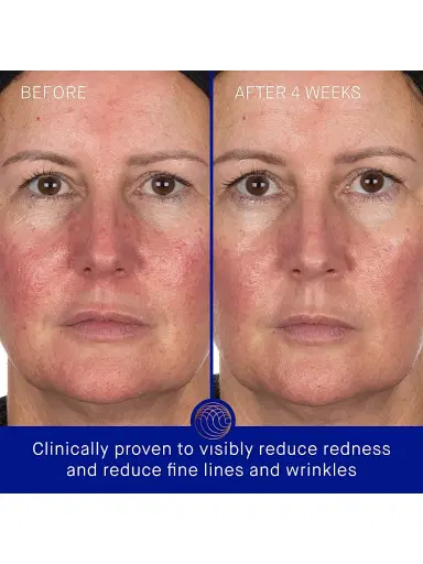 Augustinus Bader The Hydrogel Face Mask - Size Large | Thumbnail 3 Augustinus Bader The Hydrogel Face Mask - Size Large | Thumbnail 3