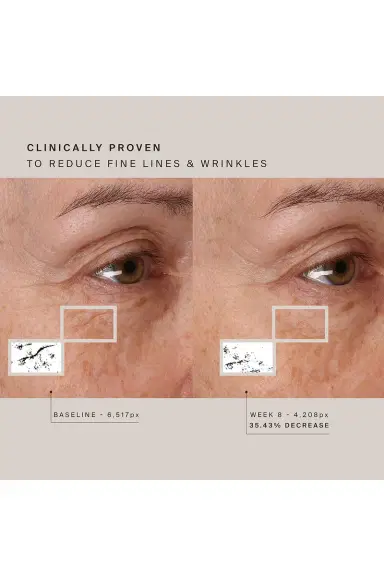 HigherDOSE Red Light Face Mask | Thumbnail 9 HigherDOSE Red Light Face Mask | Thumbnail 9