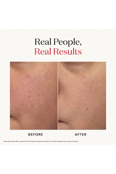 SK-II Facial Treatment Pitera Essence 11 oz | Thumbnail 11 SK-II Facial Treatment Pitera Essence 11 oz | Thumbnail 11