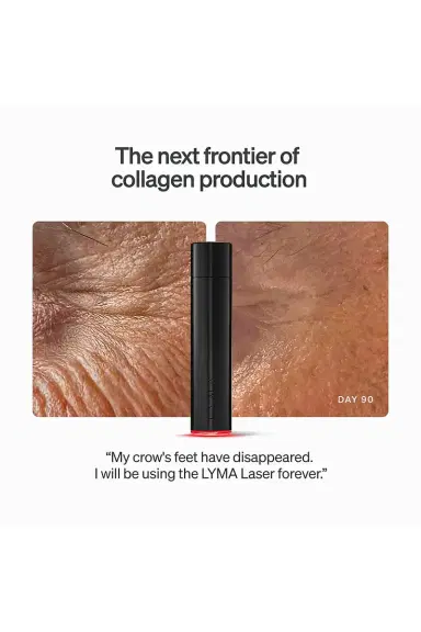 LYMA Laser Starter Kit | Thumbnail 6 LYMA Laser Starter Kit | Thumbnail 6