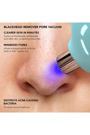 FOREO KIWI Blackhead Remover Device | Thumbnail 7 FOREO KIWI Blackhead Remover Device | Thumbnail 7