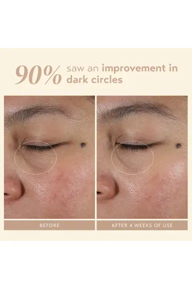 Shani Darden Skin Care Intensive Eye Renewal Cream | Thumbnail 5 Shani Darden Skin Care Intensive Eye Renewal Cream | Thumbnail 5
