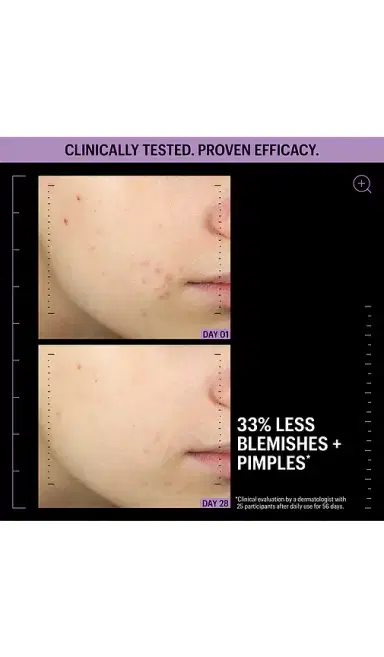 Allies of Skin Azelaic & Kojic Advanced Clarifying Serum 1oz | Thumbnail 2 Allies of Skin Azelaic & Kojic Advanced Clarifying Serum 1oz | Thumbnail 2