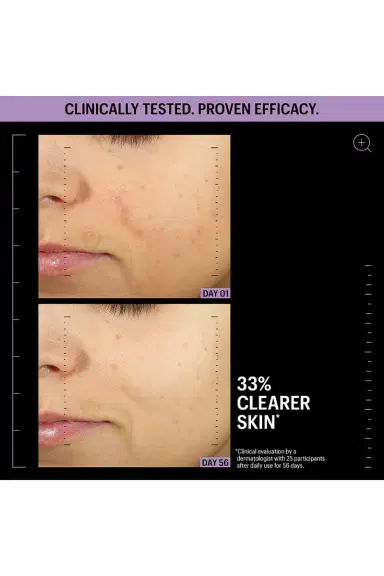 Allies of Skin Azelaic & Kojic Advanced Clarifying Serum 1oz | Thumbnail 9 Allies of Skin Azelaic & Kojic Advanced Clarifying Serum 1oz | Thumbnail 9