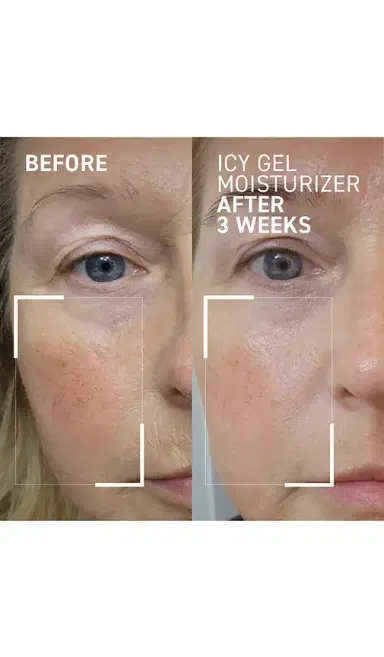 dr. brandt skincare Id-stress Icy Gel Moisturizer | Thumbnail 2 dr. brandt skincare Id-stress Icy Gel Moisturizer | Thumbnail 2