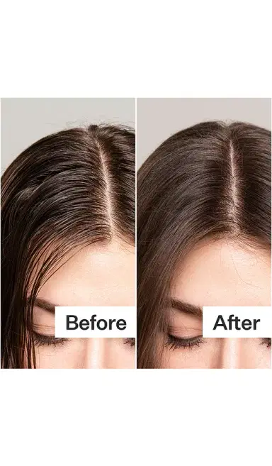 Act+Acre Act+Acre Plant Based Dry Shampoo | Thumbnail 2 Act+Acre Act+Acre Plant Based Dry Shampoo | Thumbnail 2