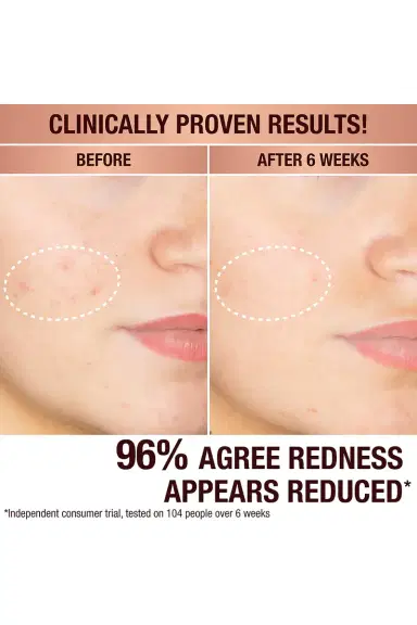Charlotte Tilbury Dark Spot Correcting Radiance Recovery Serum 10ml | Thumbnail 6 Charlotte Tilbury Dark Spot Correcting Radiance Recovery Serum 10ml | Thumbnail 6