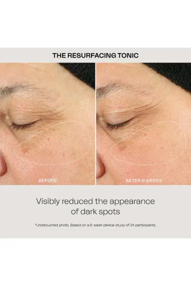 Eighth Day The Resurfacing Tonic | Thumbnail 4 Eighth Day The Resurfacing Tonic | Thumbnail 4