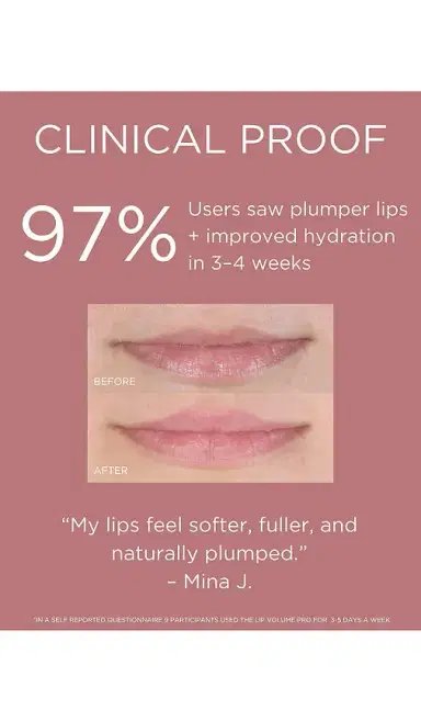 Solaris Laboratories NY LED Lip Volume Pro Plumping Treatment | Thumbnail 2 Solaris Laboratories NY LED Lip Volume Pro Plumping Treatment | Thumbnail 2