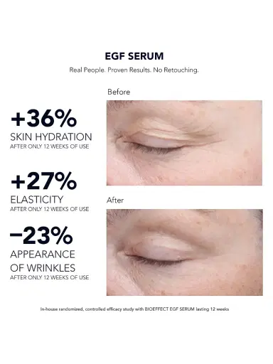 Bioeffect EGF Serum | Thumbnail 3 Bioeffect EGF Serum | Thumbnail 3
