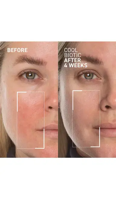dr. brandt skincare Cool Biotic Prebiotic Redness Relief Cream | Thumbnail 2 dr. brandt skincare Cool Biotic Prebiotic Redness Relief Cream | Thumbnail 2