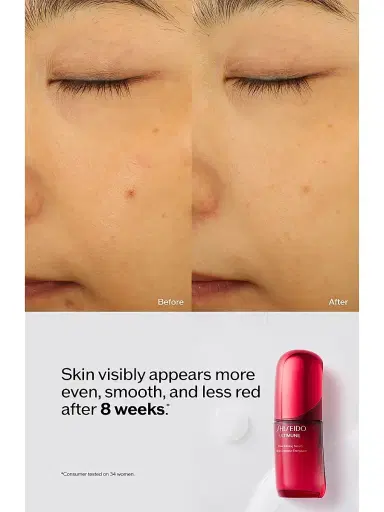 Shiseido Women's Ultimune Power Infusing Serum 2.5 oz | Thumbnail 6 Shiseido Women's Ultimune Power Infusing Serum 2.5 oz | Thumbnail 6