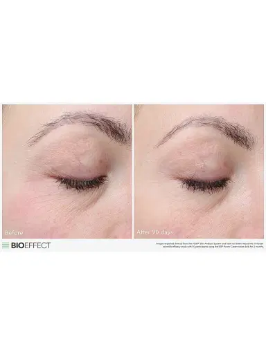 Bioeffect Women's EGF Power | Thumbnail 4 Bioeffect Women's EGF Power | Thumbnail 4