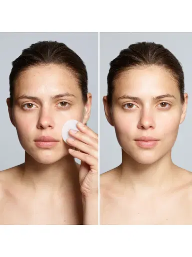 Trish McEvoy Even Skin Correct & Brighten Beta Hydroxy Pads | Thumbnail 3 Trish McEvoy Even Skin Correct & Brighten Beta Hydroxy Pads | Thumbnail 3