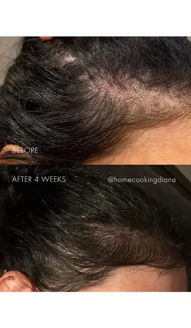 SWEED The Hair Serum | Thumbnail 2 SWEED The Hair Serum | Thumbnail 2