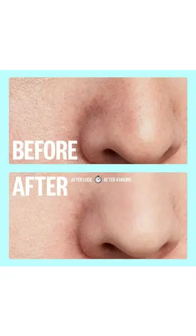 Peace Out Oil-absorbing Pore Treatment Strips | Thumbnail 2 Peace Out Oil-absorbing Pore Treatment Strips | Thumbnail 2