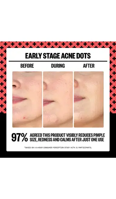 Peace Out 2% Salicylic Acid Early Stage Acne Dot 8 Dots | Thumbnail 2 Peace Out 2% Salicylic Acid Early Stage Acne Dot 8 Dots | Thumbnail 2