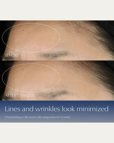Estée Lauder Advanced Night Repair Synchronized Multi-Recovery Complex Serum with Hyaluronic Acid & Peptides | Thumbnail 3 Estée Lauder Advanced Night Repair Synchronized Multi-Recovery Complex Serum with Hyaluronic Acid & Peptides | Thumbnail 3