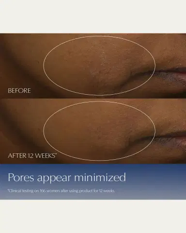 Estée Lauder Advanced Night Repair Synchronized Multi-Recovery Complex Serum with Hyaluronic Acid & Peptides | Thumbnail 5 Estée Lauder Advanced Night Repair Synchronized Multi-Recovery Complex Serum with Hyaluronic Acid & Peptides | Thumbnail 5