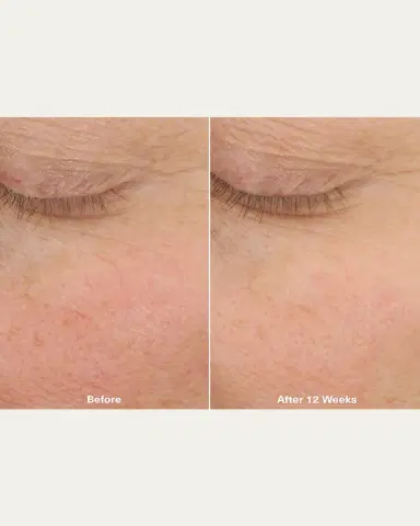 La Mer The Micro Peel Treatment, 1 oz. | Thumbnail 4 La Mer The Micro Peel Treatment, 1 oz. | Thumbnail 4
