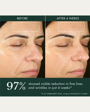 RéVive Hydrogel Moisturizer, 50 mL | Thumbnail 5 RéVive Hydrogel Moisturizer, 50 mL | Thumbnail 5